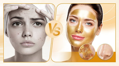 GOLDEN PEEL OF MASK {buy 1 get 1 free}